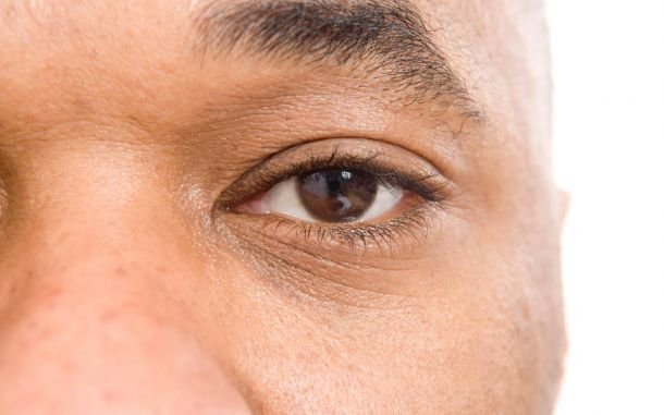 Cómo mejorar la apariencia de los ojos masculinos con cirugía plástica